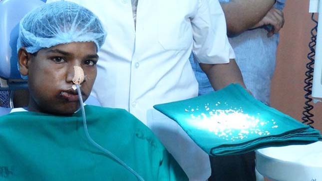 232 fogát húzták ki egy indiai fiúnak