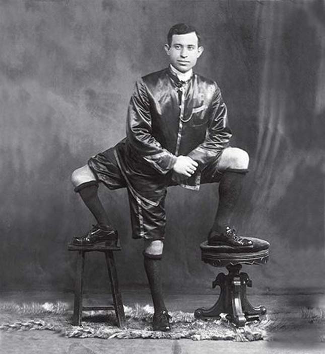 Francesco Lentini, a három lábú férfi