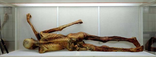 Ötzi