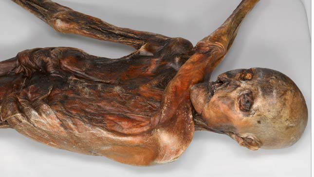 Ötzi