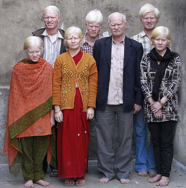 Albínók és albinoidok