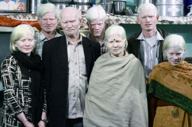 A világ legnagyobb albínó családja