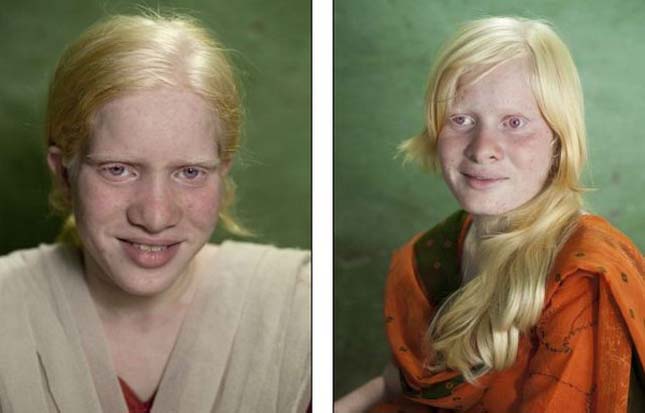 A világ legnagyobb albínó családja