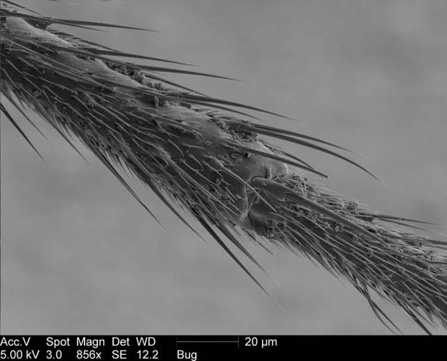 Elektronmikroszkópos képek egy szúnyogról