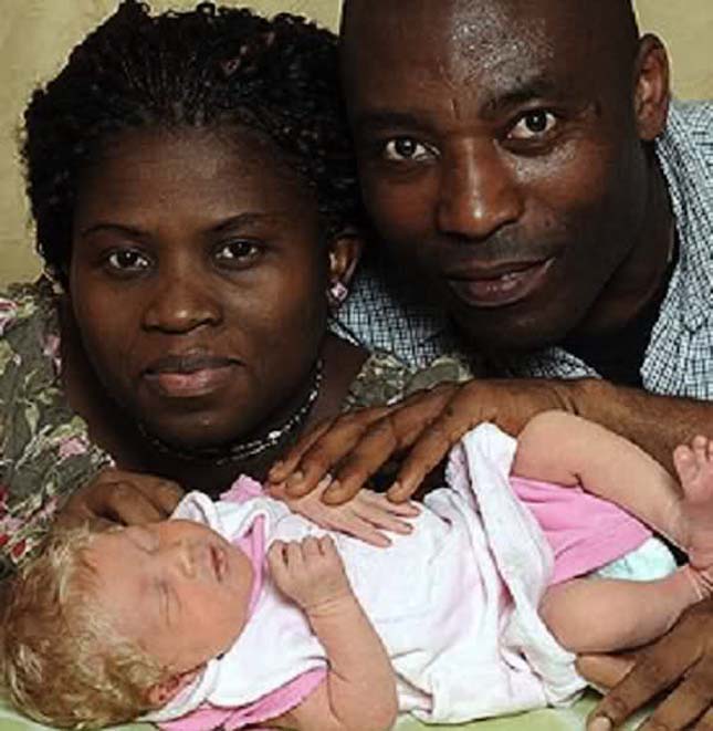 Fehér gyermeke született egy fekete bőrű házaspárnak