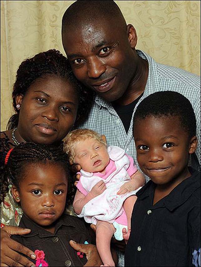 Fehér gyermeke született egy fekete bőrű házaspárnak