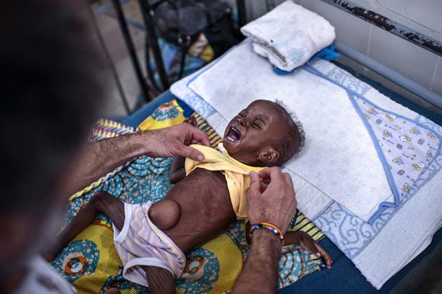 Gyermekhalálozás Afrikában
