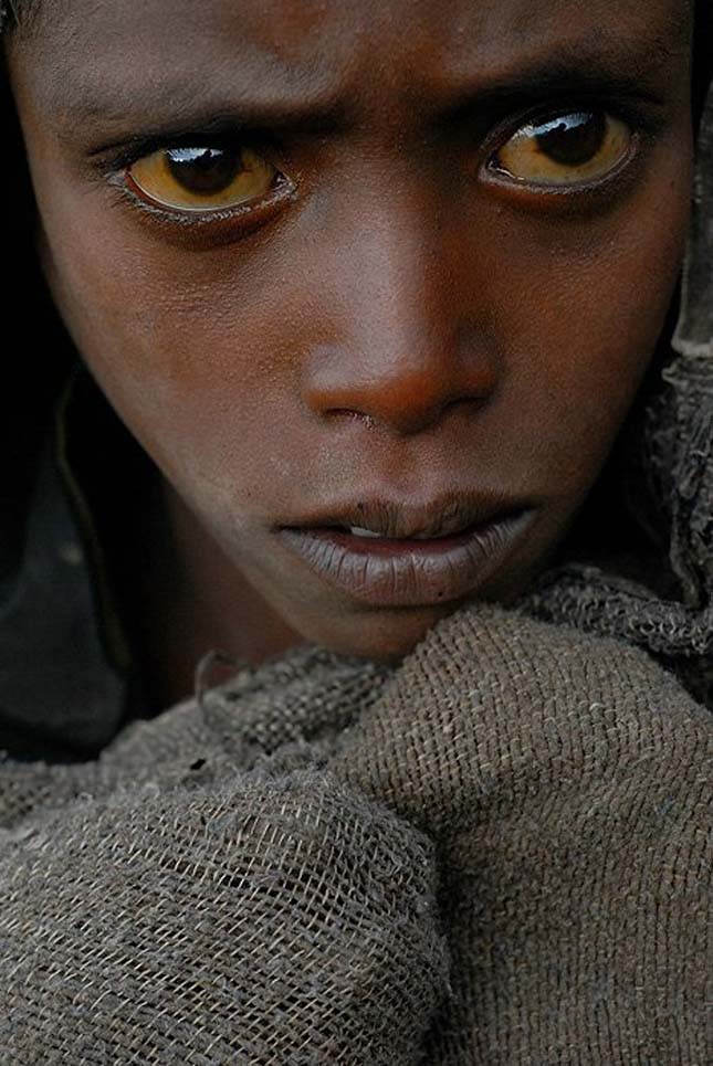 Необычный цвет глаз. Самые необычные глаза у людей. Дети с необычными глазами. Люди с необычным цветом глаз.