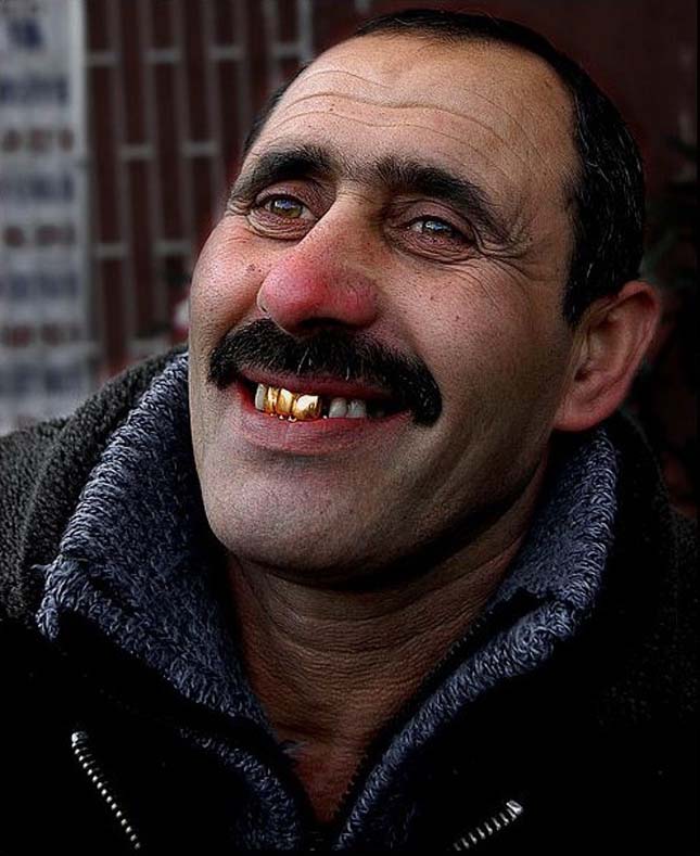 Настоящий грузин. Азербайджанец с золотыми зубами. Лицо грузина.