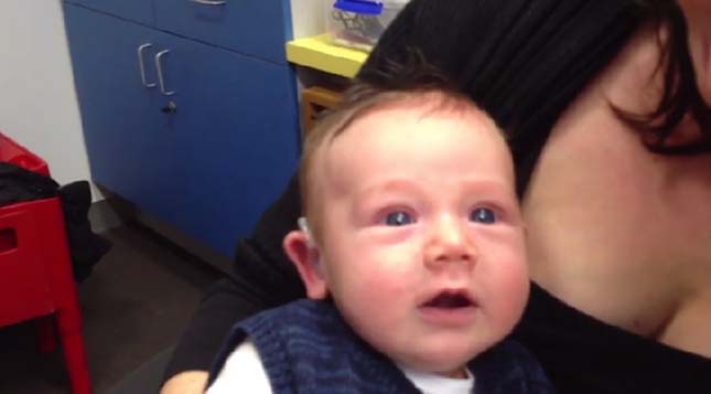 Hallássérült kisbaba először hall