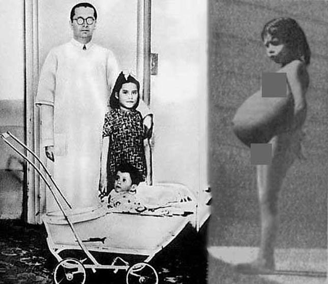 Lina Medina