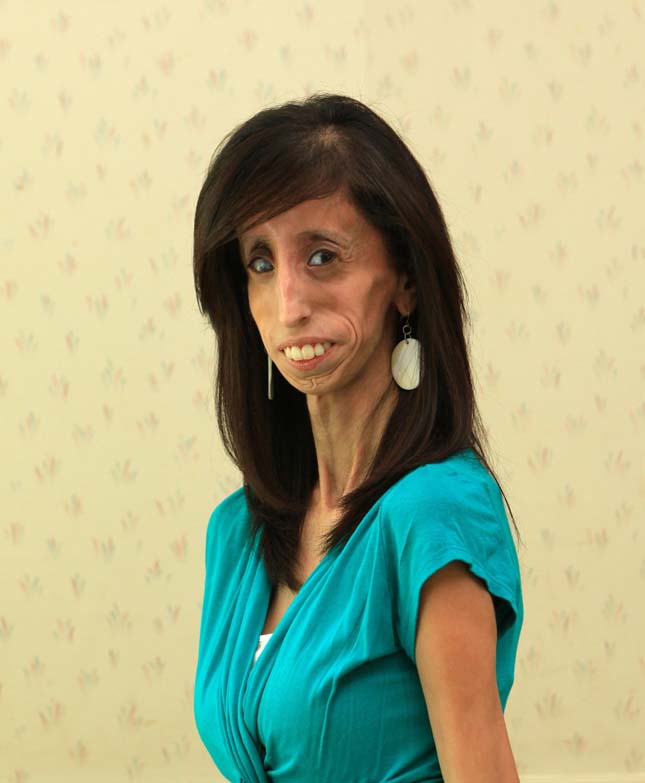 Lizzie Velasquez