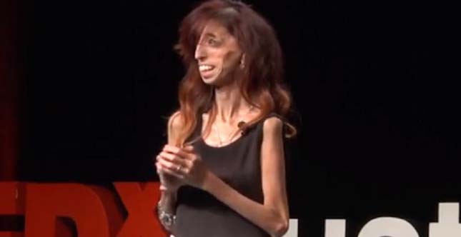 Lizzie Velasquez