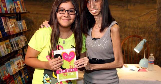 Lizzie Velasquez