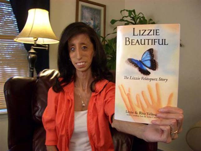 Lizzie Velasquez