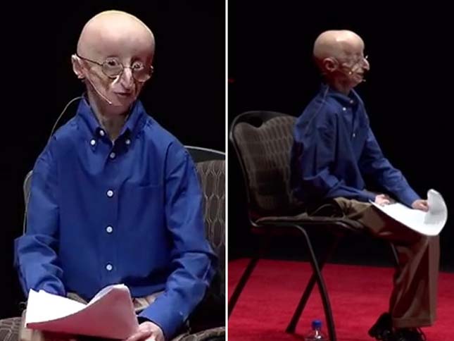 Sam Berns