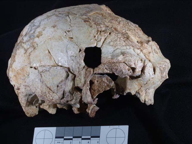 400 ezer éves koponya