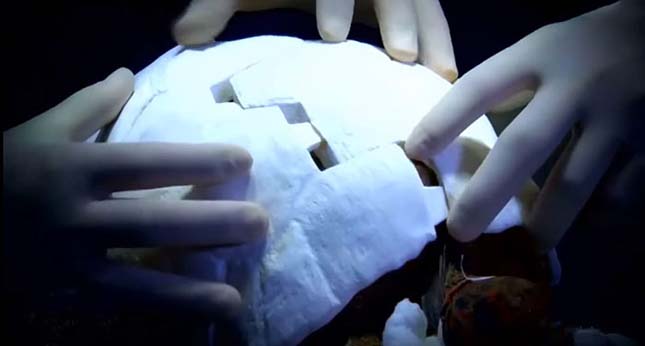 3D nyomatatóval készítettek páncélt a sérült teknősnek