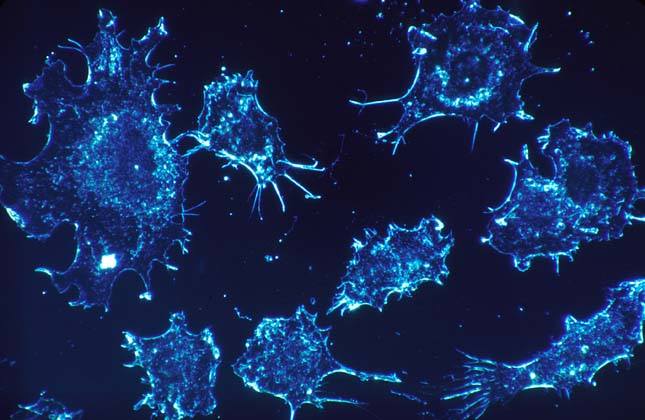 rákos fonálféreg-fertőzés talpi szemölcs mitesszerek