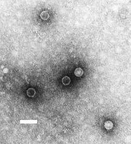 poliovirus-2