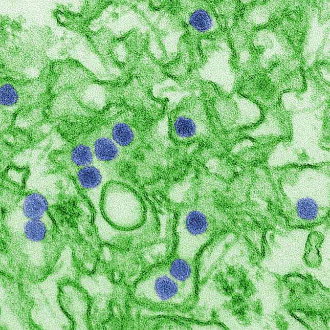 zika-virus-1