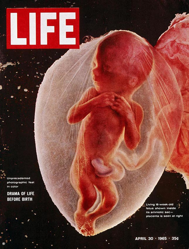 18 -week-old fetus shown inside amniotic sac.  Placenta is seen at right, used on cover of LIFE 4-30-1965, w. logo & headline.