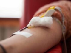 Az igazság a plazmaadásról